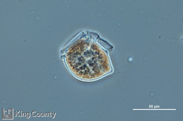Photo of Dinophysis acuta/Dinophysis norvegica
